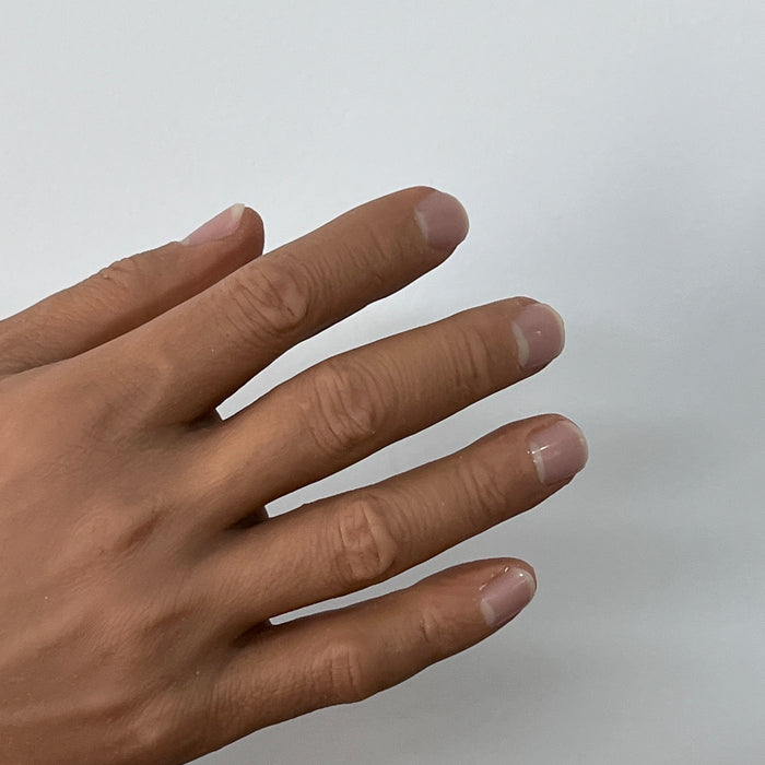 Customized Palm Prosthesis - Blackish