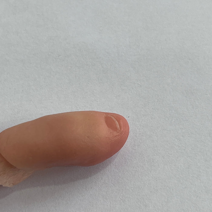 Customized toe prosthesis