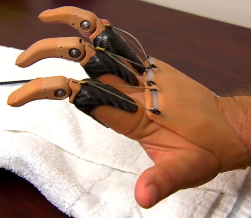 mechanical prosthetic fingers