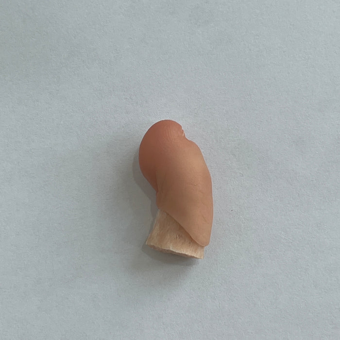 Customized toe prosthesis