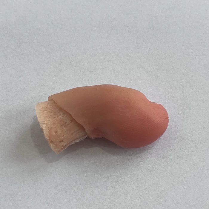 Customized toe prosthesis