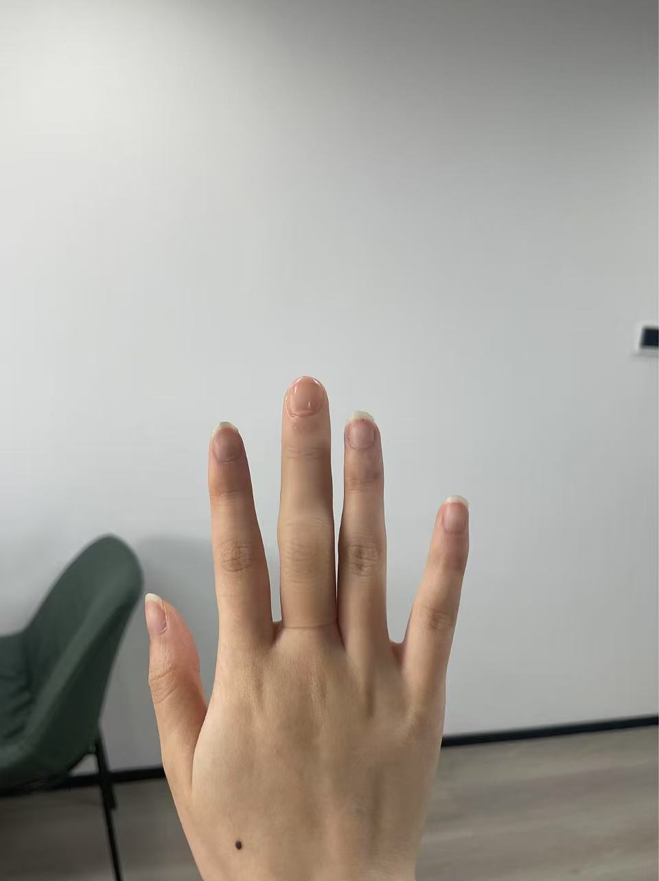 Semi-custom silicone prosthetic finger