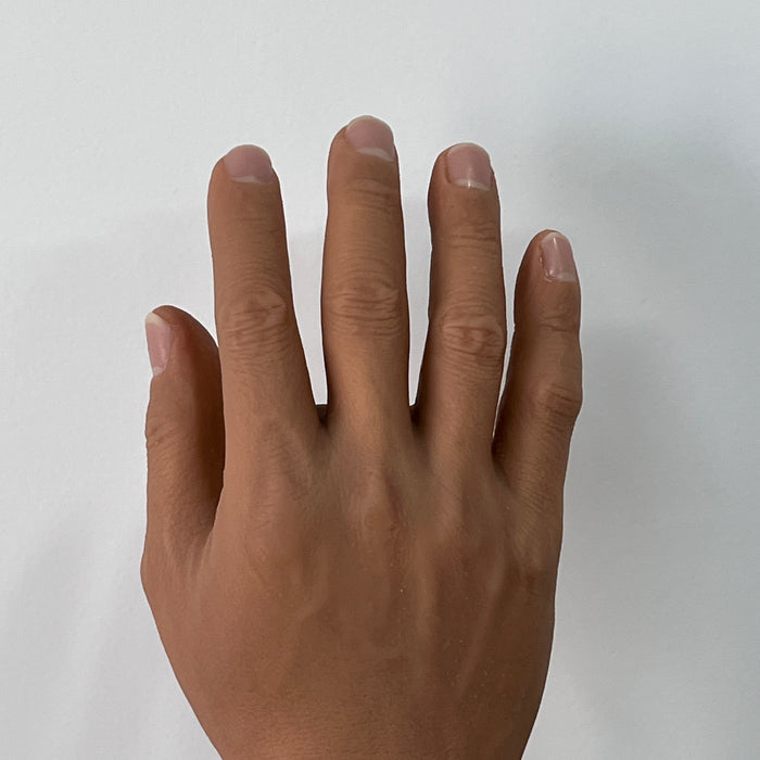 Customized Palm Prosthesis - Blackish