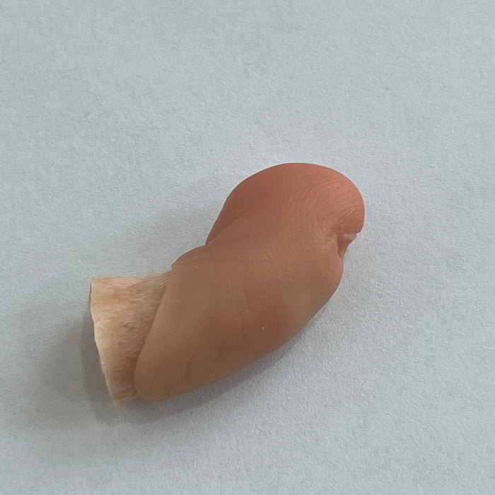 Customized toe prosthesis